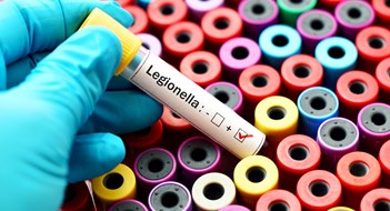 Legionnaires' Cases Reported in Washington Heights
